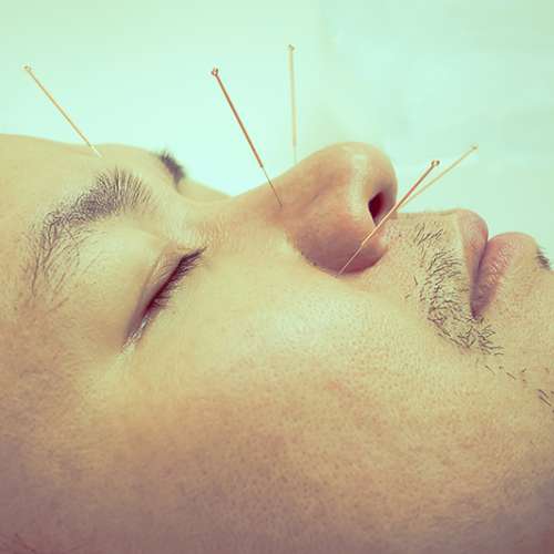Curso de acupuntura y muxibustion 2008
