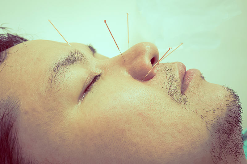 Curso de acupuntura y muxibustion 2008